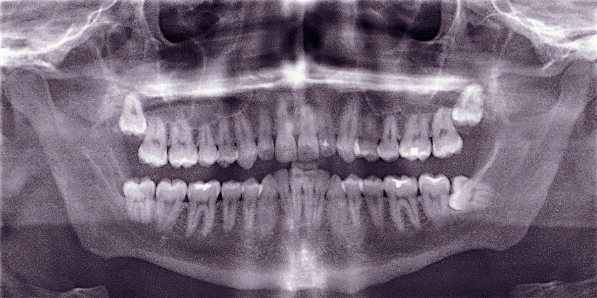 Illustrative image